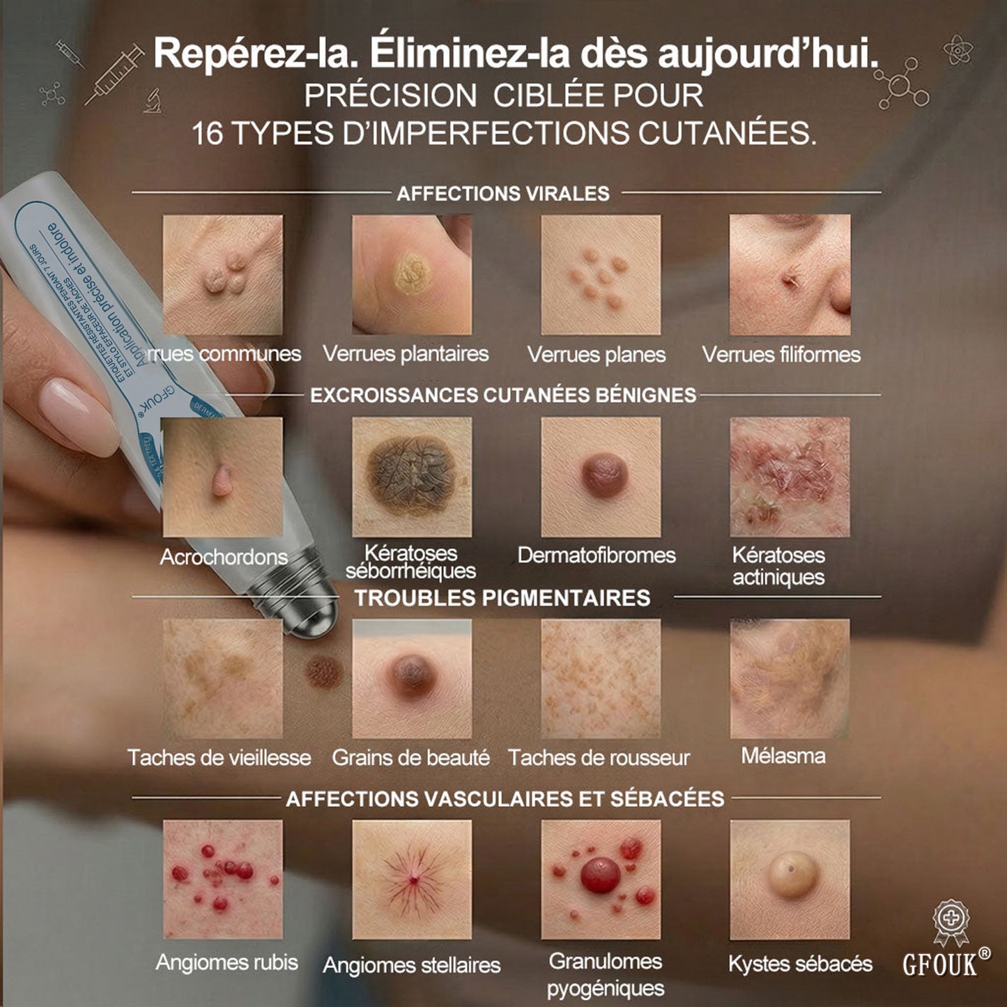 Boutique officielle de la marque |🖊️GFOUK® 7 Jours Effaceur de taches et d’excroissances cutanées(Zéro douleur, zéro cicatrice – Roller)🪴