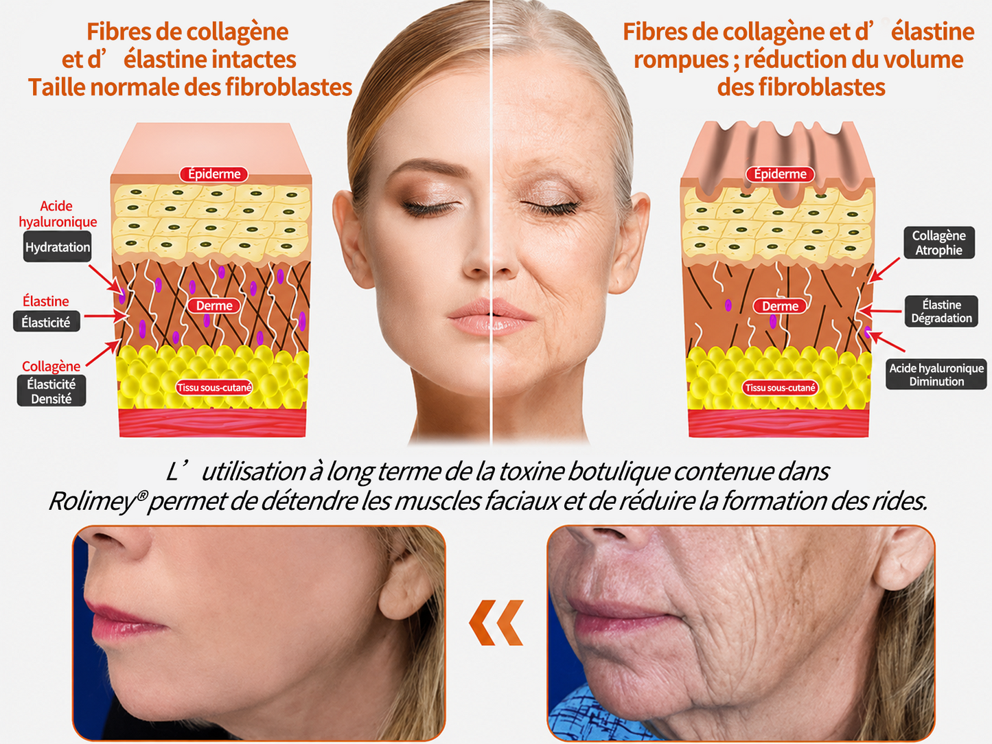 🧑‍⚕️ Crème réparatrice pour la peau Rolimey® BEE VENOM (⏳ DERNIER JOUR : -70 %) ✨