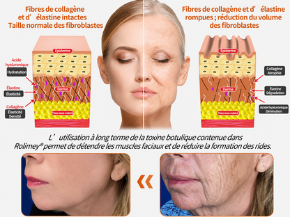 🧑‍⚕️ Crème réparatrice pour la peau Rolimey® BEE VENOM (⏳ DERNIER JOUR : -70 %) ✨