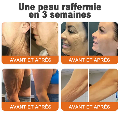 🧑‍⚕️Fabriqué et expédié depuis la France 🇫🇷 Rolimey® Stick Sérum Raffermissant au Venin d’Abeille et à l’Argireline (⏳DERNIER JOUR -70 %)✨
