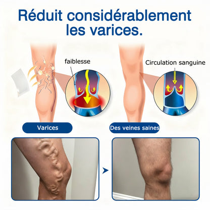 🇫🇷 🌵𝗣𝗮𝘁𝗰𝗵 𝗱𝗲 𝘀𝗼𝗶𝗻 𝗱𝗲𝘀 𝘃𝗲𝗶𝗻𝗲𝘀 𝗚𝗙𝗢𝗨𝗞® 𝗩𝗲𝗶𝗻𝗘𝗮𝘀𝗲 à 𝗺𝗶𝗰𝗿𝗼-𝗮𝗶𝗴𝘂𝗶𝗹𝗹𝗲𝘀⚡𝗦𝗼𝘂𝗹𝗮𝗴𝗲𝗺𝗲𝗻𝘁 𝗶𝗻𝘀𝘁𝗮𝗻𝘁𝗮𝗻é, 𝗿é𝘀𝘂𝗹𝘁𝗮𝘁𝘀 à 𝗹𝗼𝗻𝗴 𝘁𝗲𝗿𝗺𝗲💙