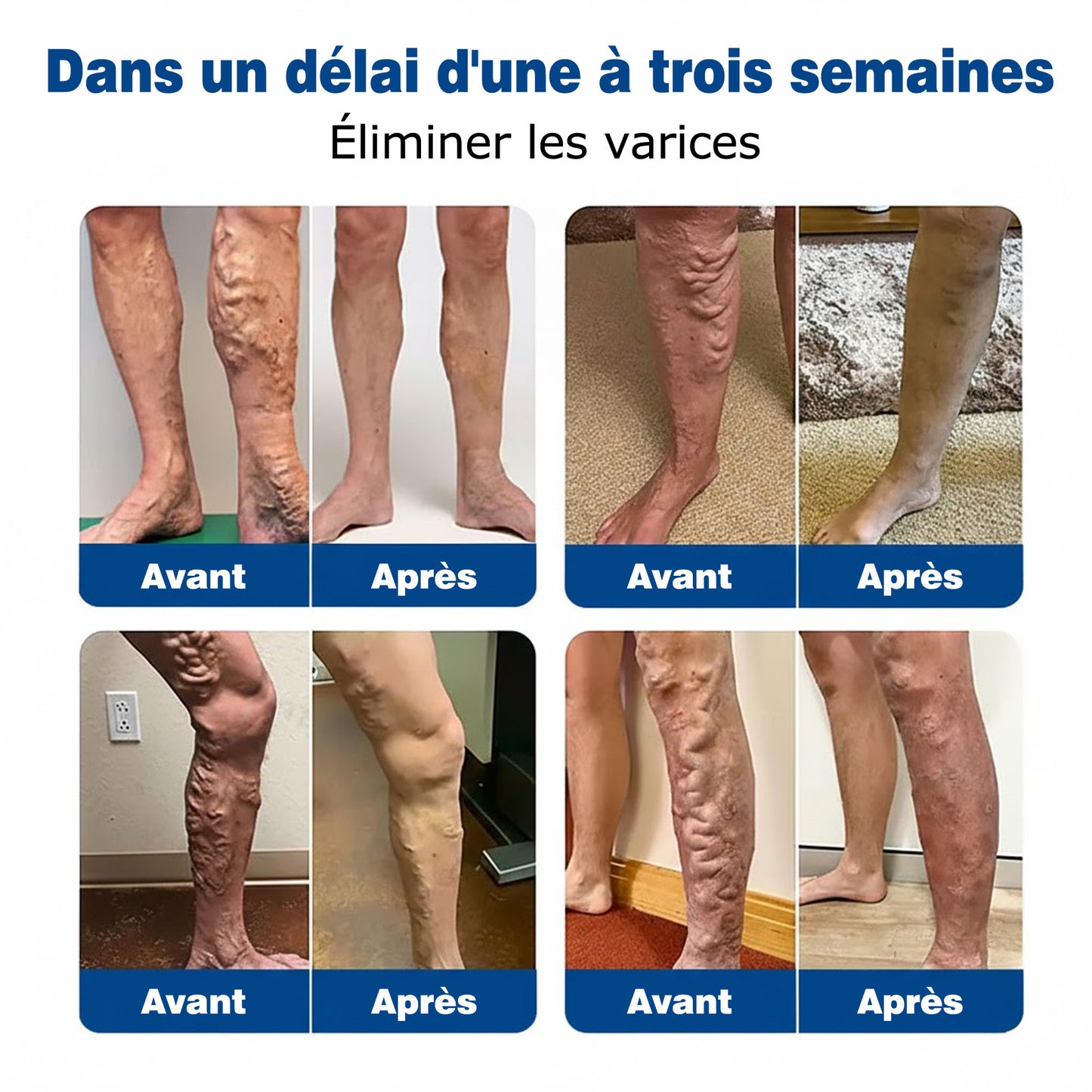 🇫🇷 🌵𝗣𝗮𝘁𝗰𝗵 𝗱𝗲 𝘀𝗼𝗶𝗻 𝗱𝗲𝘀 𝘃𝗲𝗶𝗻𝗲𝘀 𝗚𝗙𝗢𝗨𝗞® 𝗩𝗲𝗶𝗻𝗘𝗮𝘀𝗲 à 𝗺𝗶𝗰𝗿𝗼-𝗮𝗶𝗴𝘂𝗶𝗹𝗹𝗲𝘀⚡𝗦𝗼𝘂𝗹𝗮𝗴𝗲𝗺𝗲𝗻𝘁 𝗶𝗻𝘀𝘁𝗮𝗻𝘁𝗮𝗻é, 𝗿é𝘀𝘂𝗹𝘁𝗮𝘁𝘀 à 𝗹𝗼𝗻𝗴 𝘁𝗲𝗿𝗺𝗲💙