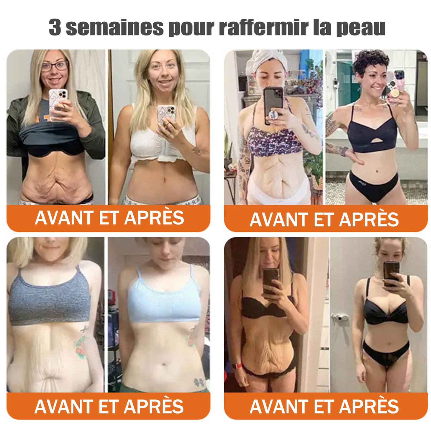 🧑‍⚕️Fabriqué et expédié depuis la France 🇫🇷 Rolimey® Stick Sérum Raffermissant au Venin d’Abeille et à l’Argireline (⏳DERNIER JOUR -70 %)✨