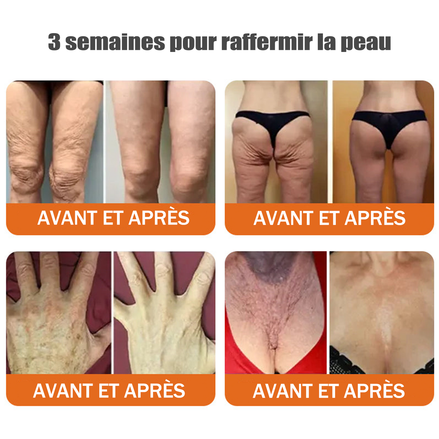 🧑‍⚕️Fabriqué et expédié depuis la France 🇫🇷 Rolimey® Stick Sérum Raffermissant au Venin d’Abeille et à l’Argireline (⏳DERNIER JOUR -70 %)✨